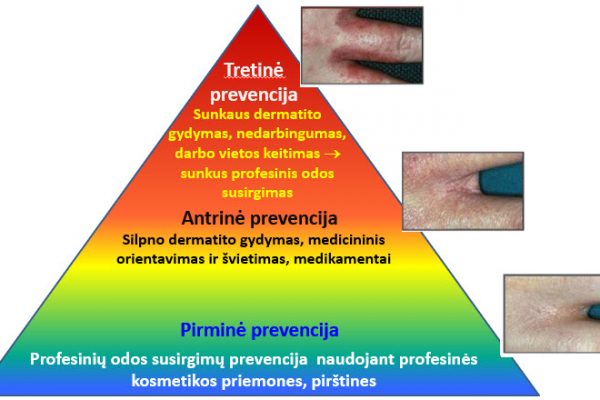 Odos ligų prevencija